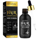 5% Minoxidil Hair Growth Serum - Biotin Hair Regrowth Treatment for Scalp Hair Loss and Thinning for Men and Women - 2.02 Fl oz (1 Month Supply)
